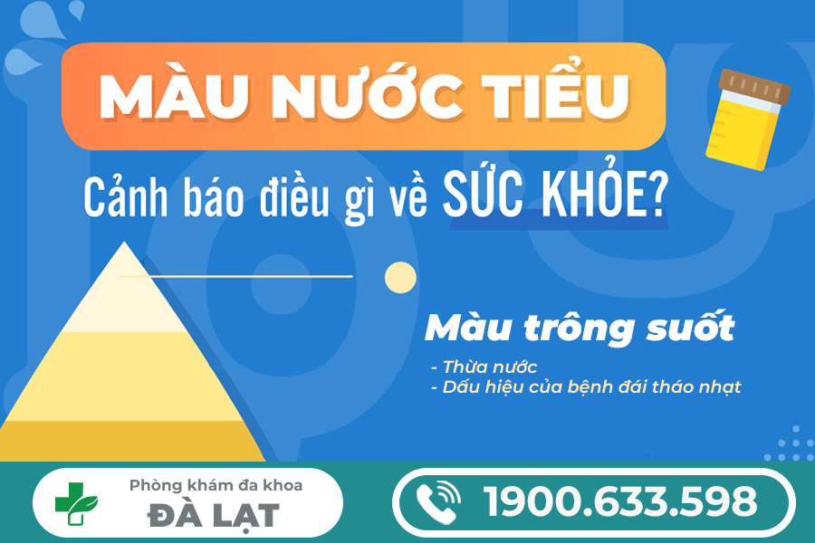 Hình ảnh minh họa